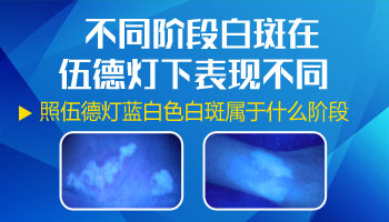 病因病理-加重白癜风病情的因素有哪些-